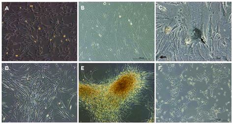 Phenotypic Characterization Of Humscs And Thumscs Humscs During Download Scientific Diagram