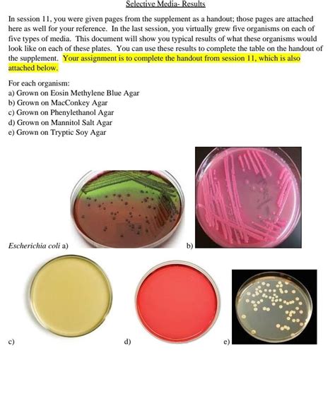 Macconkey Agar Composition Principle Uses And Procedure