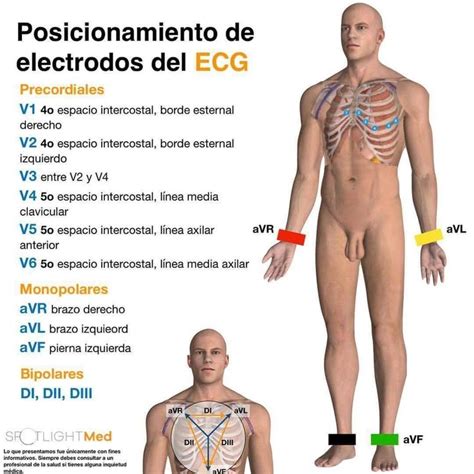 Electrodos Ekg Iam Instagram