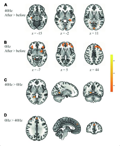 Greater Brain Activation Is Associated With Comparisons Between Download Scientific Diagram