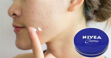 Beneficios De La Nivea Que Te Sorprenderán Notas Buenas