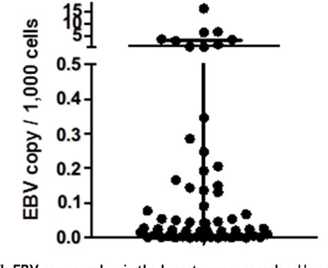 Figure From Role Of Epstein Barr Virus In Breast Cancer Correlation