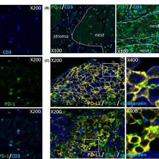 Expression Of Immunecheckpoint Molecule Icm Ligands In Head And Neck