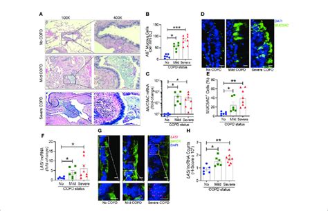 | Archived airway sections of COPD patients show increased mucus ... 