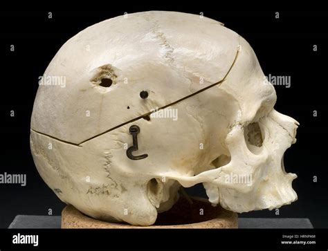 Pistola traumatica fotografías e imágenes de alta resolución Alamy