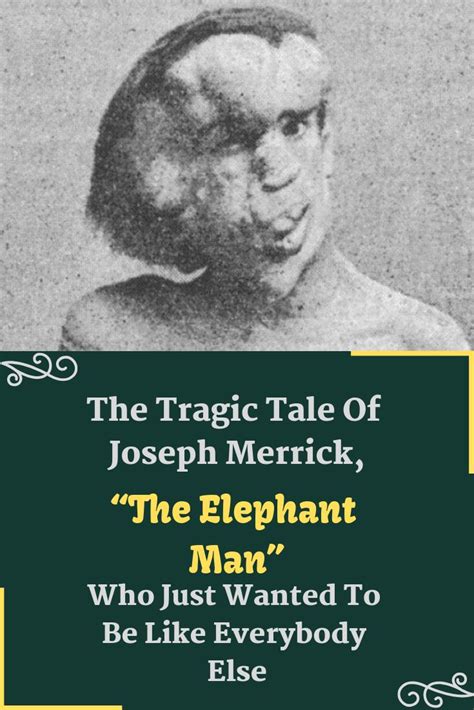 The Tragic Tale Of Joseph Merrick The Elephant Man” Who Just Wanted