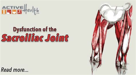 Condition of the Month: Sacroiliac Joint Dysfunction - Chiropractor ...