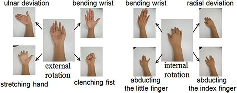 View 26 Ulnar Nerve Palsy Test - soonartinterests