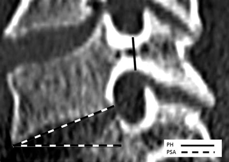 Sagittal Computed Tomography Reconstruction Download Scientific Diagram