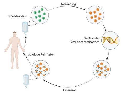 Car T Zell Therapie In Der Soliden Onkologie Onkologie Heute