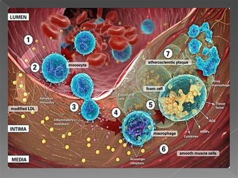 Cardiac biomarkers