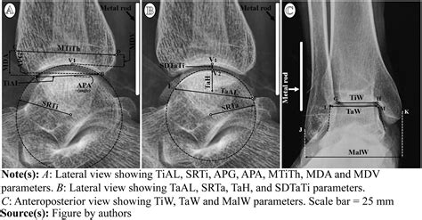 Anthropometric Evaluation Of Side Sex And Age By Radiological