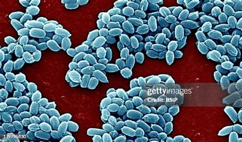 Microscopic Image Of Bacillus Anthracis Stock Fotos Und Bilder Getty