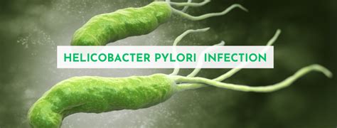 All About Helicobacter pylori (H. pylori) Infection