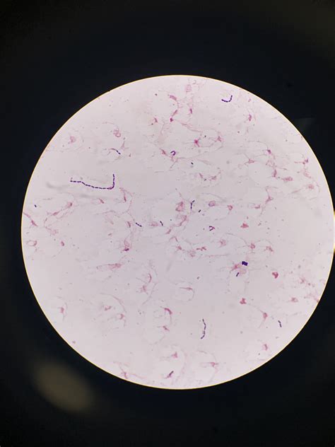 Enterococcus Gram Stain