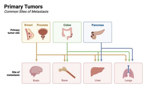 Primary Tumors And Their Common Sites Of Metastasis BioRender Science