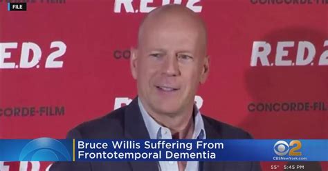 Bruce Willis diagnosed with frontotemporal dementia - CBS New York