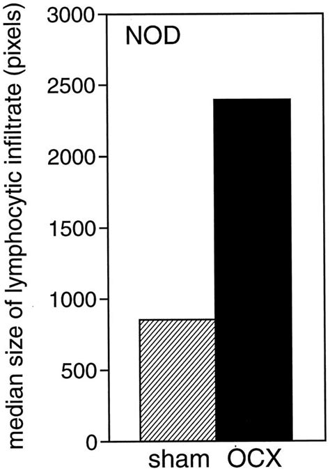 Sex Steroids Influence Pancreatic Islet Hypertrophy And Subsequent