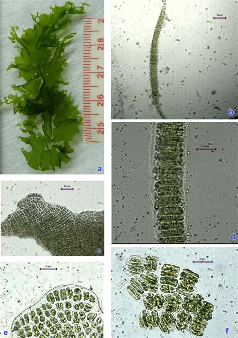 a. General habit of thallus, b. Cross section of the thallus in low ...