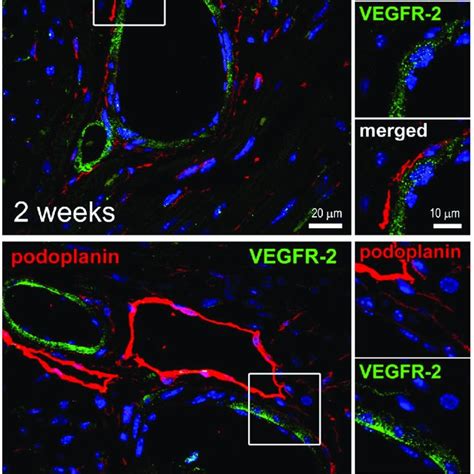 Perivascular Localization Of The Podoplanin Expressing Cells Thin