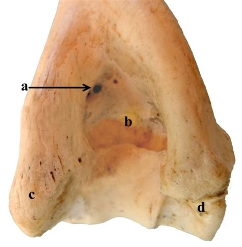 Distal Extremity Of The Humerus Showing Nutrient Foramen A Olecranon