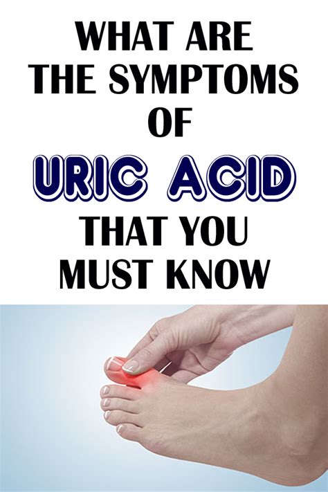 High Uric Acid Symptoms : Pin on Uric acid : A high concentration of ... 