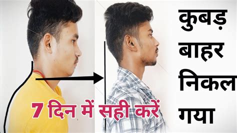 Kubadpan Thik Karne Ke Liye Exercise How To Improve Back Posture