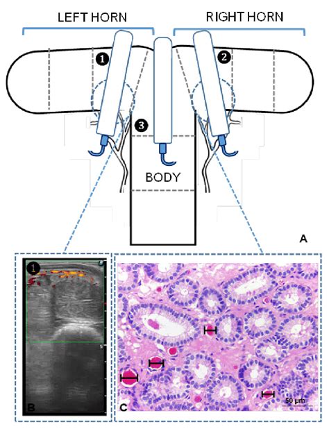 A Diagram Of The Transrectal Placement Of A Linear Array Ultrasound Download Scientific