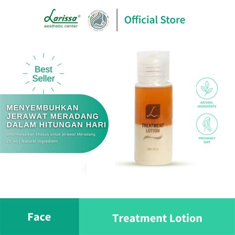 Jual Larissa Treatment Lotion Jerawat Meradang Parah Membandel