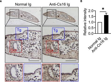 Clonorchis Sinensis Calcium Binding Protein Cs16 Causes Acute Hepatic