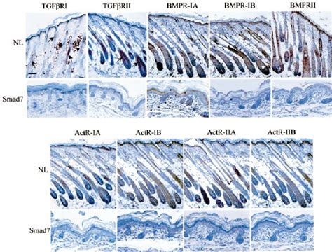 Immunohistochemical Staining For Tgf B R Actr And Bmpr Non Transgenic