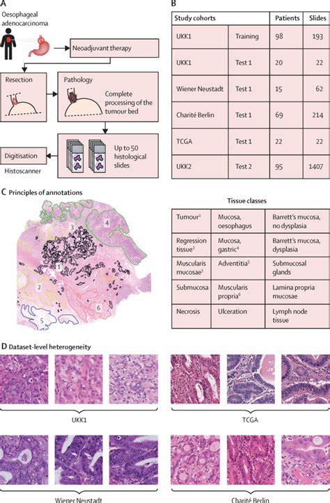 Artificial Intelligence For Tumour Tissue Detection And Histological