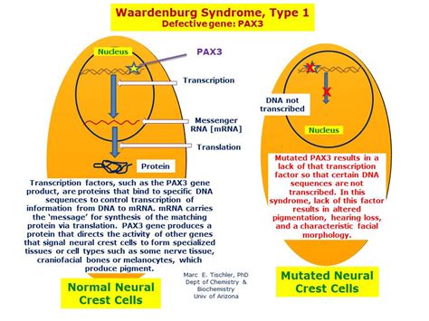 Waardenburg Syndrome Type 1 Hereditary Ocular Diseases