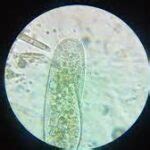 29+ Protoctista Examples: Detailed Facts - LAMBDAGEEKS