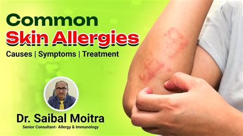 Common Skin Allergies Causes Symptoms Treatment Best Allergy