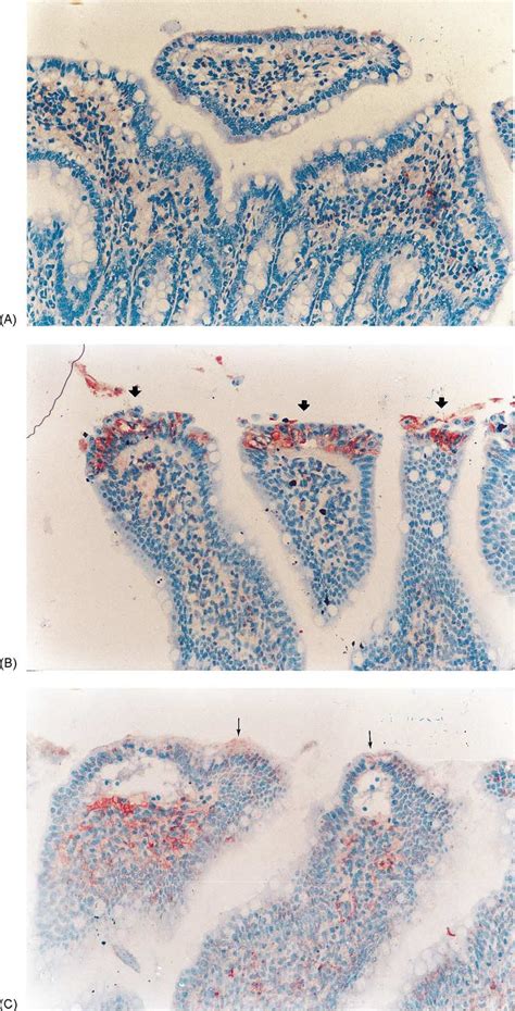 Photomicrographs Of Immunohistochemical Assessment Of Inos ×200