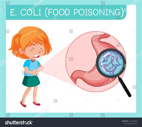 1 E Coli Food Poisoning Symptoms Stock Vectors And Vector Art Shutterstock