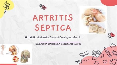 Artritis Septica Chan Dominguez UDocz