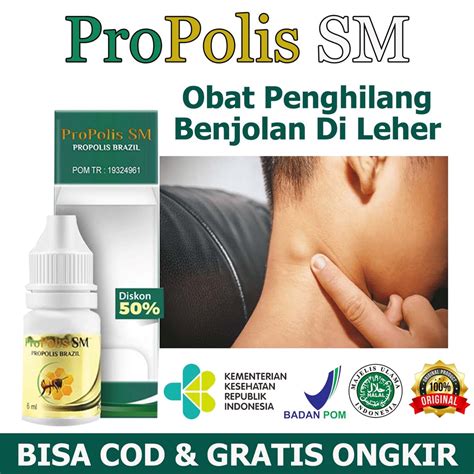 Jual Propolis SM Brazil Original Obat Benjolan Di Leher Tangan Perut