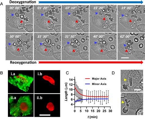 Microfluidic Study Of Retention And Elimination Of Abnormal Red Blood