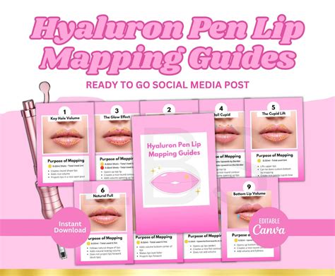 Hyaluron Pen Lip Mapping Dermal Lip Fillers Lip Maps Russian Lips