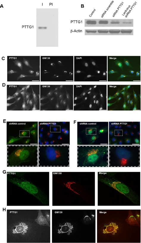 Pttg1 Protein Is Associated To The Ga A Cell Extracts From Rpe1