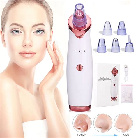 Wireless Rechargeable Face Nose Pore Acne Cleanser Electric Beauty