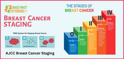 Breast Cancer Staging From Diagnosis To Treatment Instant Steroid