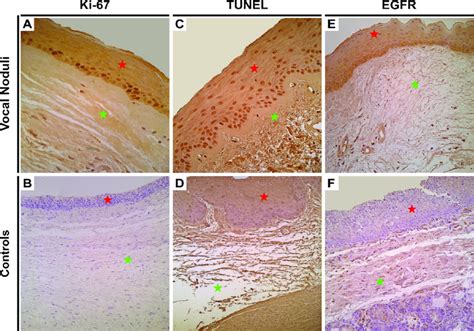 Immunohistochemical Assessment Of Epithelial Proliferation Apoptosis