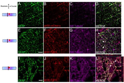 Transduced Astrocytes Express Iii Tubulin Weeks After Sci Schemes