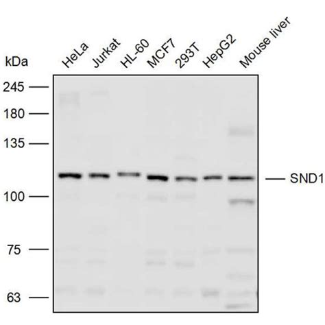 Solarbio K P Anti Snd Polyclonal Antibody