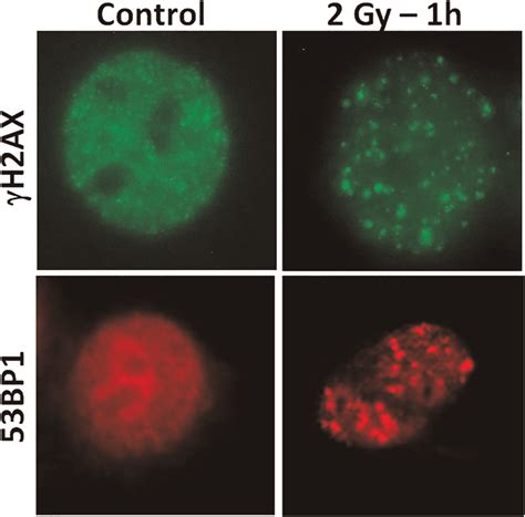 Representative Microphotographs Of Human Cells With Foci Ag