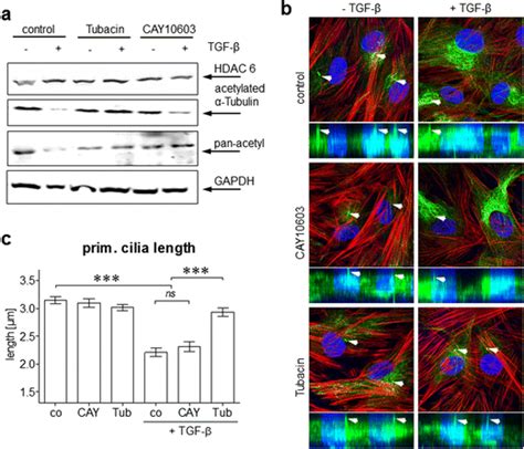 Blocking Hdac6 Activity Restores Tubulin Acetylation And Primary Cilium