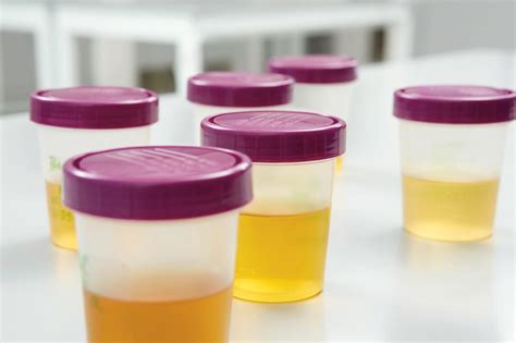 Specialty Urine Testing